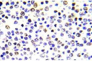 Immunohistochemistry analysis of Histone H3. (Histone H3.1 Antikörper)