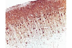 Immunohistochemical staining on a rat brain formalin-fixed paraffin-embedded section with citrate buffer pretreatment (20X magnification). (ERK (Pan) (AA 219-358) Antikörper)