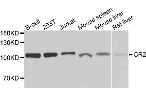 Western blot analysis of extracts of various cells, using CR2 antibody. (CD21 Antikörper)