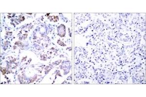 Immunohistochemistry (IHC) image for anti-Nuclear Factor-kB p65 (NFkBP65) (AA 221-270) antibody (ABIN2889039) (NF-kB p65 Antikörper  (AA 221-270))
