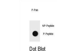 Dot blot analysis of Phospho-PTEN- Antibody Phospho-specific Pab (ABIN6241052 and ABIN6578937) on nitrocellulose membrane. (PTEN Antikörper  (pThr382))