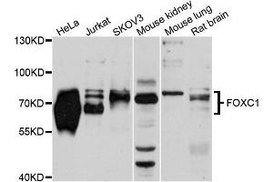 Western blot analysis of extracts of various cells, using FOXC1 antibody. (FOXC1 Antikörper)
