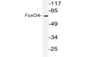 Western blot (WB) analyzes of FoxO4 antibody in extracts from COLO205 cells. (FOXO4 Antikörper)