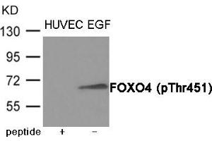 Western blot analysis of extracts from HUVEC cells treated with EGF using FOXO4 (Phospho-Thr451) Antibody. (FOXO4 Antikörper  (pThr451))