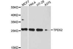 Western blot analysis of extracts of various cell lines, using TPD52 antibody. (TPD52 Antikörper  (AA 1-184))