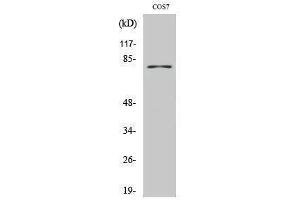 Western Blotting (WB) image for anti-Tyrosinase (TYR) (C-Term) antibody (ABIN3177845) (TYR Antikörper  (C-Term))