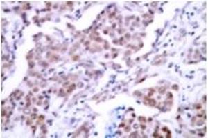 Image no. 2 for anti-Tumor Protein P53 (TP53) (pSer15) antibody (ABIN318091) (p53 Antikörper  (pSer15))