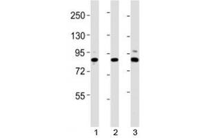 Western blot testing of Suz12 antibody at 1:2000 dilution. (SUZ12 Antikörper  (AA 381-395))