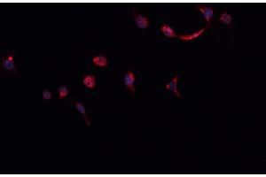 ABIN6268824 staining HeLa cells by IF/ICC. (HNRNPM Antikörper  (N-Term))