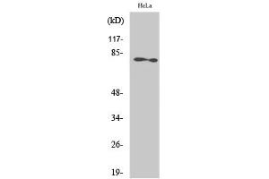 Western Blotting (WB) image for anti-Protein Kinase C, zeta (PRKCZ) (Thr410) antibody (ABIN5957395) (PKC zeta Antikörper  (Thr410))