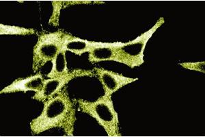 Immunofluorescence staining of HeLa cells. (PKA RIIalpha (AA 1-404) Antikörper)