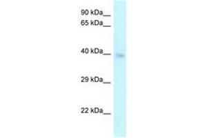 Image no. 1 for anti-Cysteine-Rich with EGF-Like Domains 2 (CRELD2) (C-Term) antibody (ABIN6747709) (CRELD2 Antikörper  (C-Term))