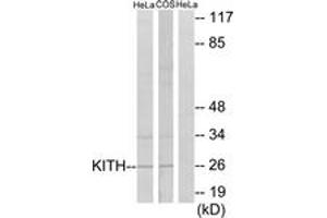 Western blot analysis of extracts from HeLa/COS7 cells, using KITH Antibody. (TK1 Antikörper  (AA 161-210))