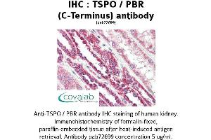 Image no. 1 for anti-Peripheral-Type Benzodiazepine Receptor (TSPO) (C-Term) antibody (ABIN1740430) (TSPO Antikörper  (C-Term))