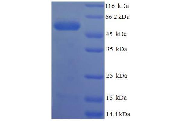 PRSS23 Protein (AA 20-383) (His-SUMO Tag)