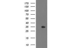 Western Blotting (WB) image for anti-Haloacid Dehalogenase-Like Hydrolase Domain Containing 2 (HDHD2) antibody (ABIN1498631) (HDHD2 Antikörper)