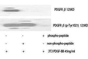 Western Blotting (WB) image for anti-Platelet Derived Growth Factor Receptor beta (PDGFRB) (pTyr1021) antibody (ABIN3173423) (PDGFRB Antikörper  (pTyr1021))