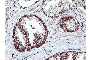 Image no. 2 for anti-Nonhomologous End-Joining Factor 1 (NHEJ1) antibody (ABIN1499733) (NHEJ1 Antikörper)