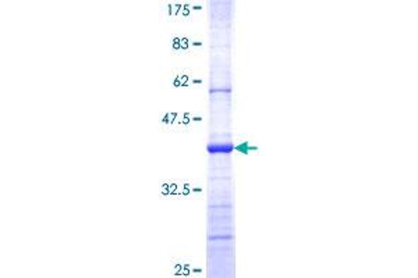 PLA2G6 Protein (AA 124-233) (GST tag)