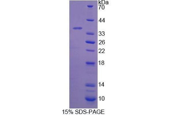 beta-Thromboglobulin Protein (beta-TG)