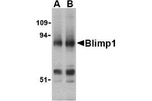 Image no. 1 for anti-PR Domain Containing 1, with ZNF Domain (PRDM1) (N-Term) antibody (ABIN200138) (PRDM1 Antikörper  (N-Term))
