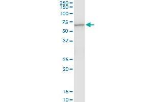 Western Blotting (WB) image for anti-Cystinosis, Nephropathic (CTNS) (AA 1-100) antibody (ABIN560527)