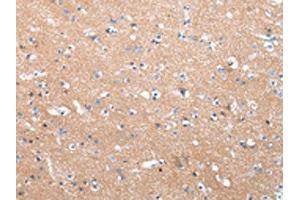 The image on the left is immunohistochemistry of paraffin-embedded Human brain tissue using ABIN7190332(COLEC12 Antibody) at dilution 1/40, on the right is treated with synthetic peptide. (COLEC12 Antikörper)