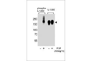 Western blot analysis of extracts from A431 cells,untreated or treated with EGF,100 ng/mL , using phospho-ERBB2-(left) or ERBB2 Antibody (right) (ErbB2/Her2 Antikörper  (pTyr1139))