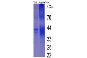 Image no. 1 for Angiotensin II (Ang II) peptide (Ovalbumin) (ABIN5666082) (Angiotensin II (Ang II) peptide (Ovalbumin))