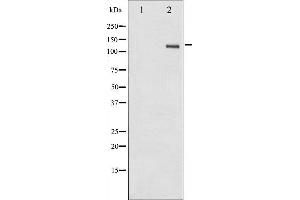 Western blot analysis of FAK phosphorylation expression in HepG2 whole cell lysates,The lane on the left is treated with the antigen-specific peptide. (FAK Antikörper  (pTyr861))