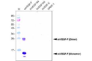 Western Blot Analysis using a Protein-A purified antibody against svVEGF-F (Bothrops Insularis). (VEGF-F / SvVEGF (AA 24-146) Antikörper)