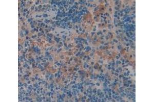 IHC-P analysis of Rat Tissue, with DAB staining. (GZMM Antikörper  (AA 19-251))