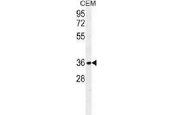 NUDT22 Antikörper  (C-Term)