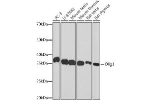Western blot analysis of extracts of various cell lines, using Olig1 Rabbit mAb (ABIN1682245, ABIN3015404, ABIN3015405 and ABIN7101349) at 1:1000 dilution. (OLIG1 Antikörper)