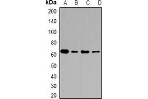 Western blot analysis of CD36 expression in MCF7 (A), A431 (B), mouse brain (C), mouse lung (D) whole cell lysates. (CD36 Antikörper)