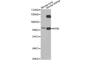 Western blot analysis of extracts of various cell lines, using MSN antibody. (Moesin Antikörper)