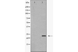 Western blot analysis of Claudin 5 expression in A549 cell,The lane on the left is treated with the antigen-specific peptide. (Claudin 5 Antikörper)