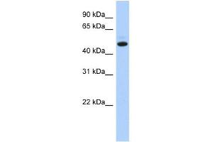 WB Suggested Anti-C5orf36 Antibody Titration: 0. (C5orf36 Antikörper  (N-Term))