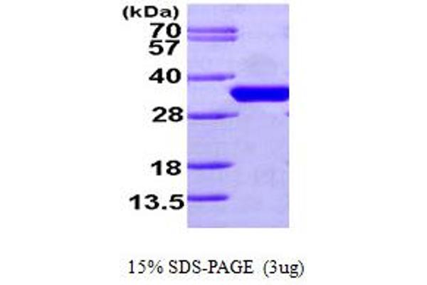 CDC34 Protein (AA 1-236) (His tag)