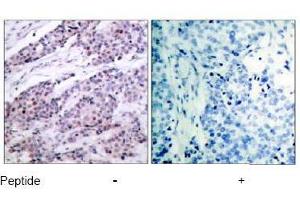 Image no. 1 for anti-B-Cell CLL/lymphoma 2 (BCL2) (AA 54-58) antibody (ABIN197202) (Bcl-2 Antikörper  (AA 54-58))