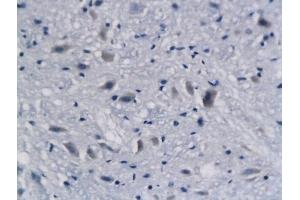 Formalin-fixed and paraffin embedded mouse brain labeled with Anti-DCX Polyclonal Antibody, Unconjugated (ABIN674184) followed by conjugation to the secondary antibody and DAB staining (Doublecortin Antikörper)