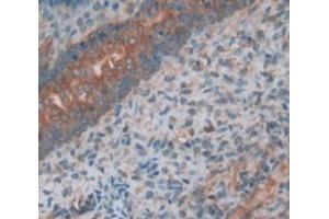 IHC-P analysis of Kidney tissue, with DAB staining. (PLAP Antikörper  (AA 68-313))