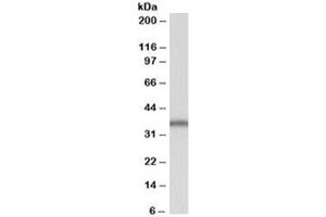 Western blot testing of Daudi lysate with SLC9A3R2 antibody at 1ug/ml. (SLC9A3R2 (Isoforms b & E) Antikörper)