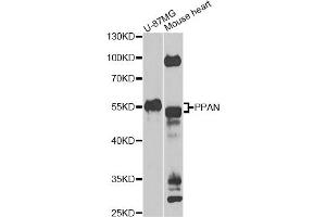 Western blot analysis of extracts of various cell lines, using PPAN Antibody. (PPAN Antikörper)