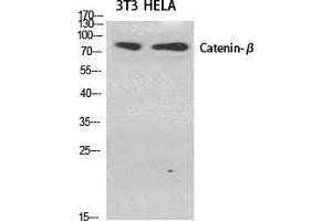 Western Blot (WB) analysis of specific cells using Catenin-beta Polyclonal Antibody. (beta Catenin Antikörper  (Ser29))