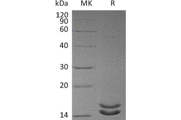 IL-2 Protein (His tag)