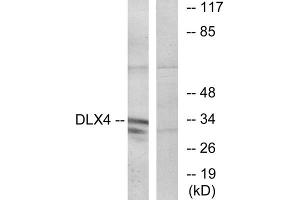 Western blot analysis of extracts from COLO cells, using DLX4 antibody. (DLX4 Antikörper  (Internal Region))