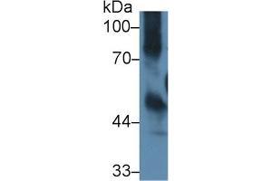 Detection of ICAM1 in Mouse Thymus lysate using Polyclonal Antibody to Intercellular Adhesion Molecule 1 (ICAM1) (ICAM1 Antikörper  (AA 328-465))