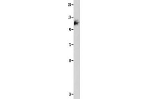 Western Blotting (WB) image for anti-Amphiphysin (AMPH) antibody (ABIN2427737) (Amphiphysin Antikörper)