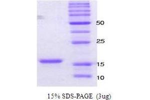 Figure annotation denotes ug of protein loaded and % gel used. (alpha Synuclein A30P A53T (active) Protein)